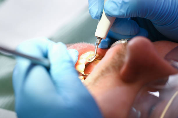 Best Emergency Dental Services for Seniors in Shaw, MS